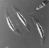Phaeosphaeria barriae - Appendage