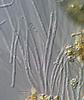 Jahnula potamophila - Hamathecium