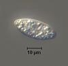 Hyalorostratum  brunneisporum  - additional image