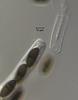 Hyalorostratum  brunneisporum  - additional image