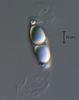 Magnisphaera stevemossago - Appendage