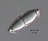Magnisphaera stevemossago - Ascospore