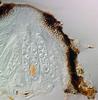 Lindgomyces lemonweirensis - Peridium