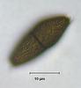 Jahnula bipileata - additional image