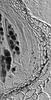 Phaeosphaeria barriae - Peridium