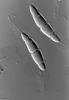 Phaeosphaeria barriae - additional image