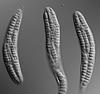 Isthmosporella pulchra - Ascus
