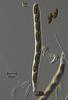 Jahnula sangamonensis - Ascus