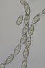 Bullimyces communis - additional image