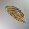 Echria gigantospora - Ascus