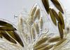 Echria gigantospora - additional image