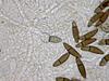 Jahnula apiospora - additional image