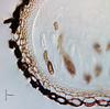 Jahnula apiospora - Peridium