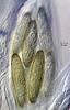 Echria gigantospora - additional image