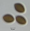 Lockerbia striata - additional image