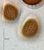 Lockerbia striata - additional image
