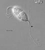 Pseudoproboscispora caudae-suis - Appendage