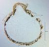 Physalospora limnetica - Ascomata