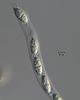 Pseudoproboscispora caudae-suis - additional image