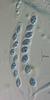 Physalospora limnetica - Ascus