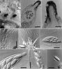 Physalospora vaccinii - additional image