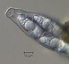 Aniptodera lignatilis - additional image