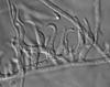 Pseudohalonectria phialidica - Anamorph