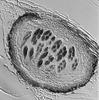 Macrospora scirpicola - Ascomata