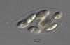 Fluviatispora reticulata - additional image