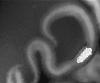 Macrospora scirpicola - additional image