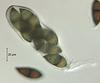 Megalohypha aqua-dulces - Ascus