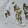 Megalohypha aqua-dulces - Peridium