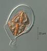 Lepidopterella palustris - Ascospore