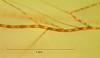 Megalohypha aqua-dulces - additional image